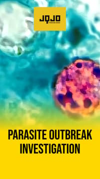 United States investigates multistate cyclosporiasis outbreak source
