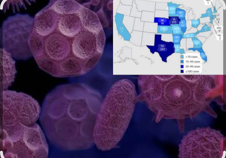 Épidémie historique de Cyclospora : plus de 9 400 personnes malades dans 17 États