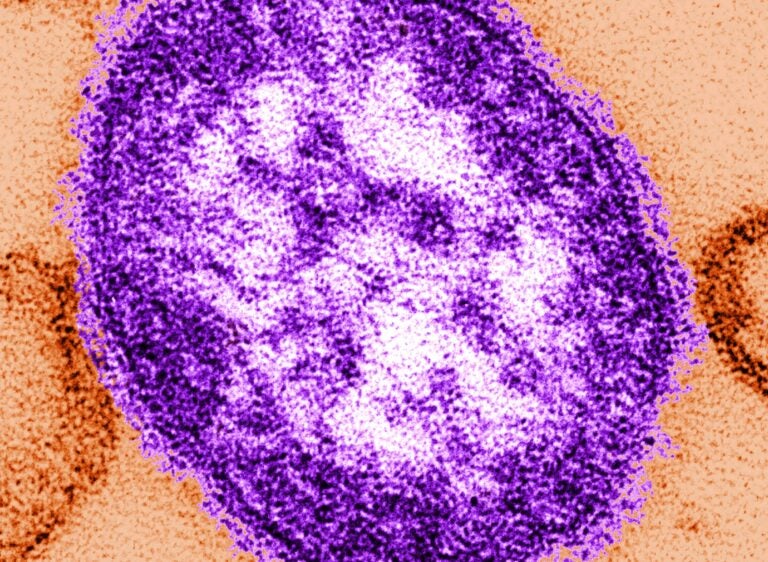 Deux personnes non vaccinées meurent dans une épidémie de rougeole en Pennsylvanie