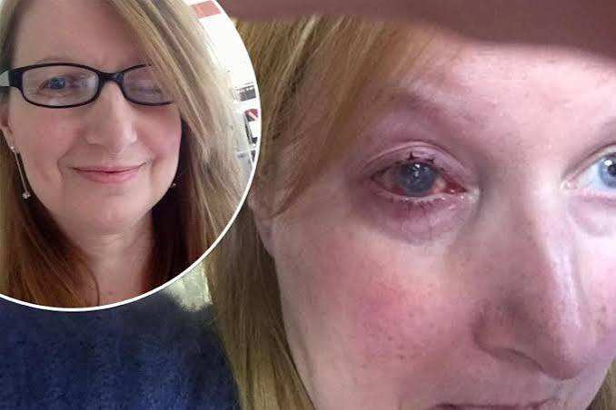 ¿Se está quedando ciega por usar lentillas en la ducha? ¿Podría pasarte a ti?