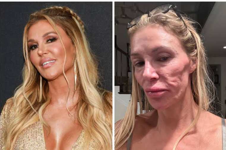 Brandi Glanville Says She Is Wasting Away on IV Treatments Amid Health Battle
