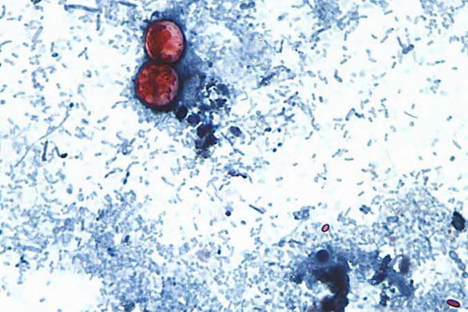 Cyclospora Outbreak Exposes Gap in FDA Foreign Food Inspections