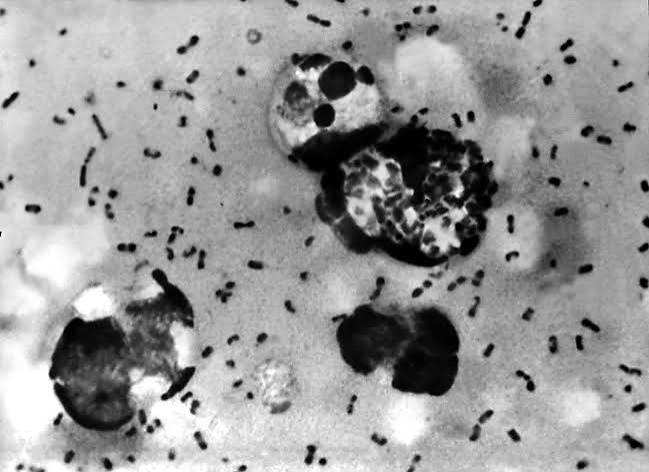 Décès suspect de peste dans un laboratoire russe déclenche un confinement « anti-épidémique »