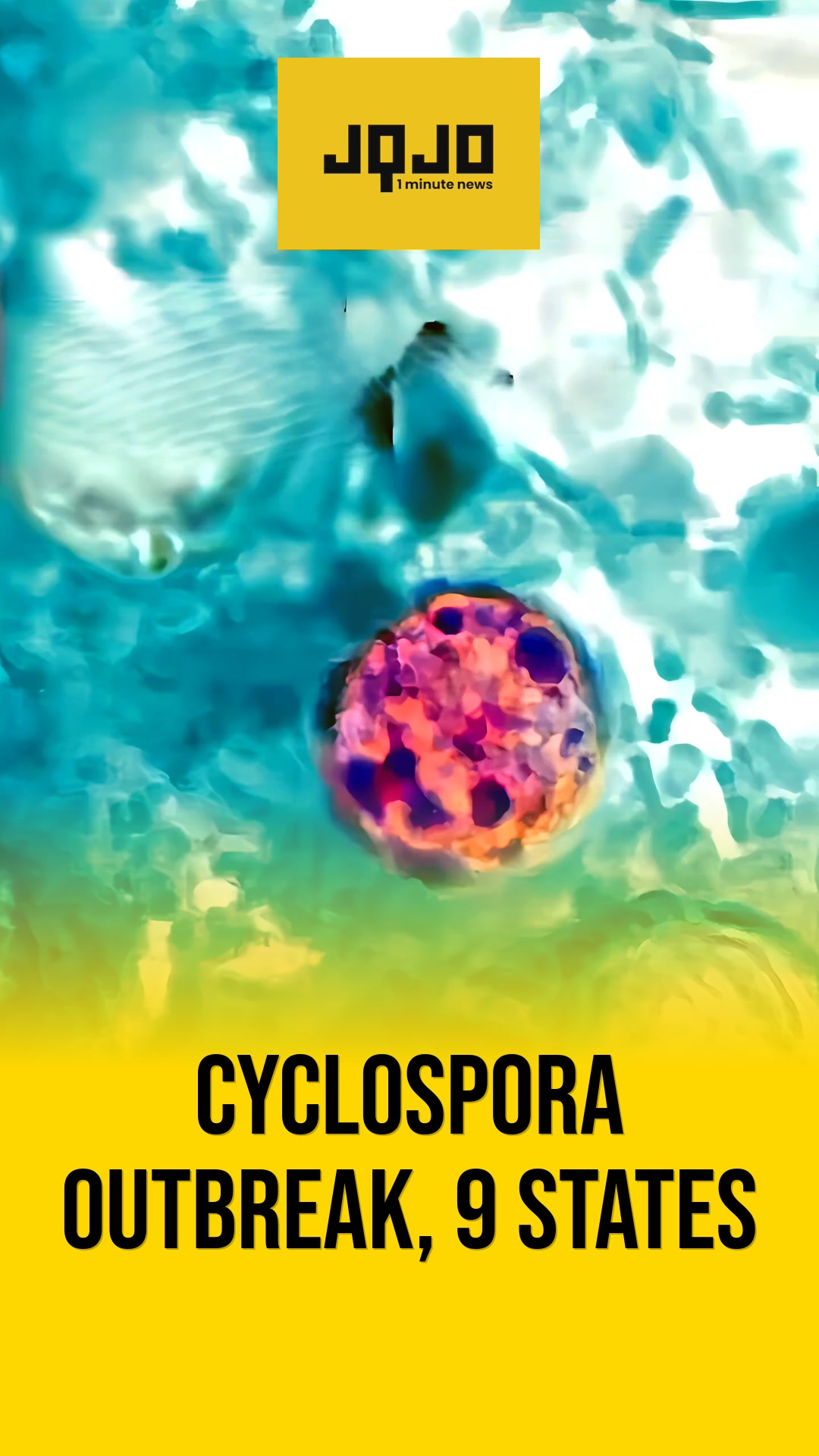 Massive Cyclosporiasis Outbreak Spreads to Nine States With Over 12,000 Cases Reported